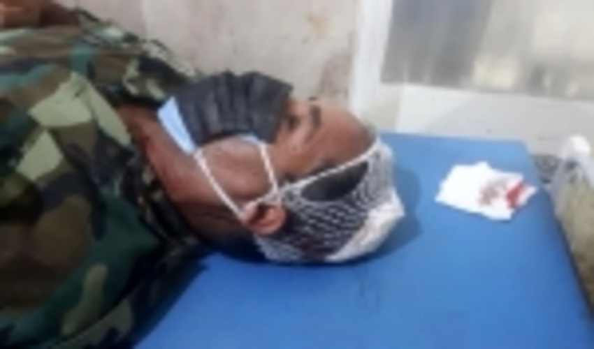 حمله با تبر به جنگلبان گلستانی 