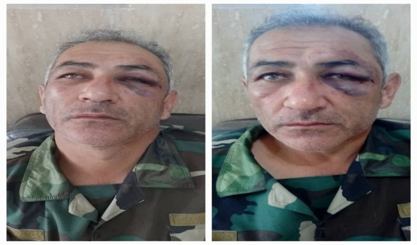 گیلان / بار دیگر ضرب و شتم جنگلبان